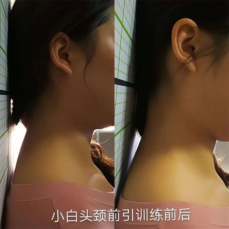 成功案例 